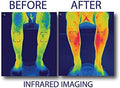 Foot Neuropathy Machine – EMS TENS Circulation & Pain Relief